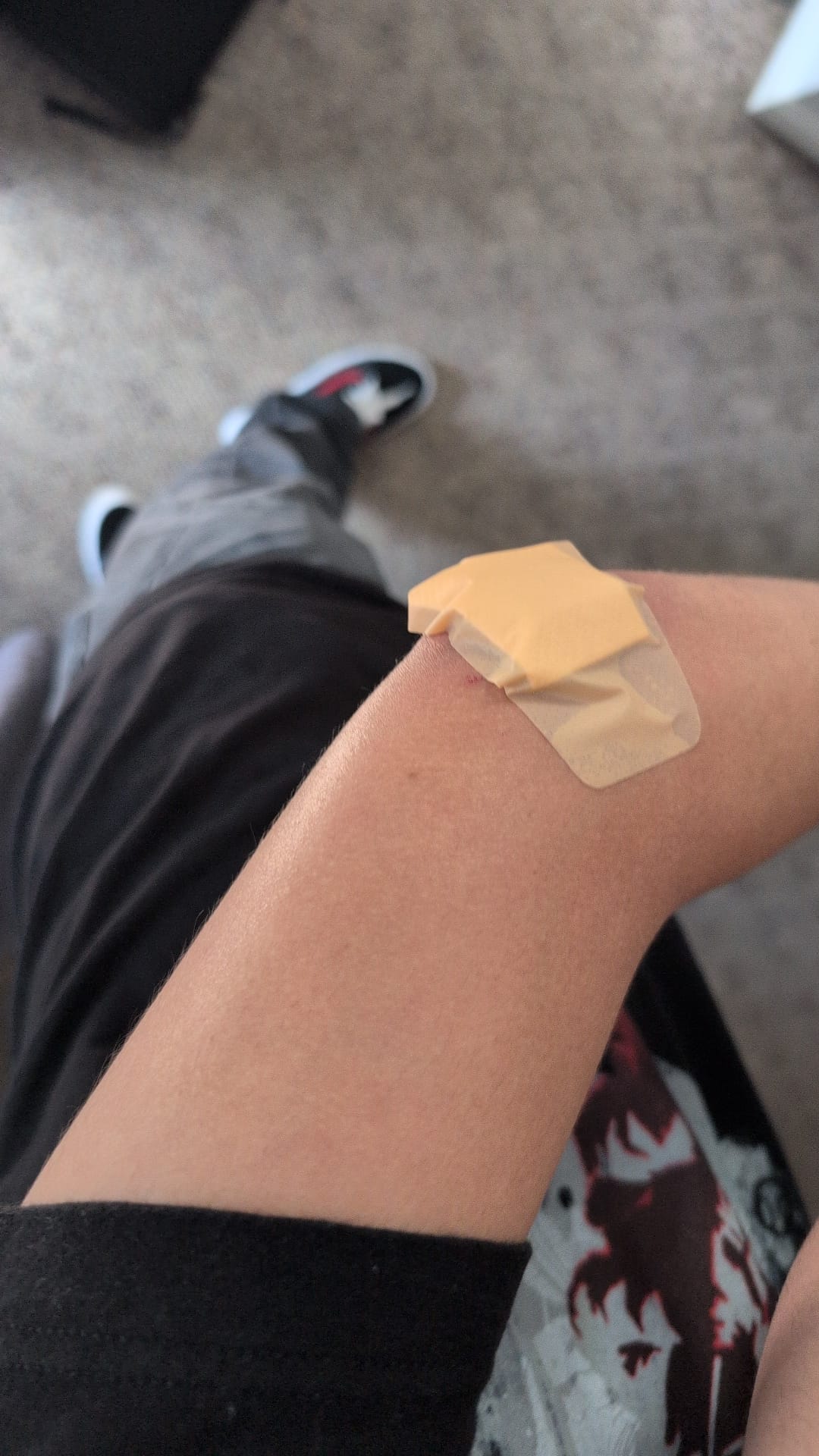 Elbow of person with large bandage visible